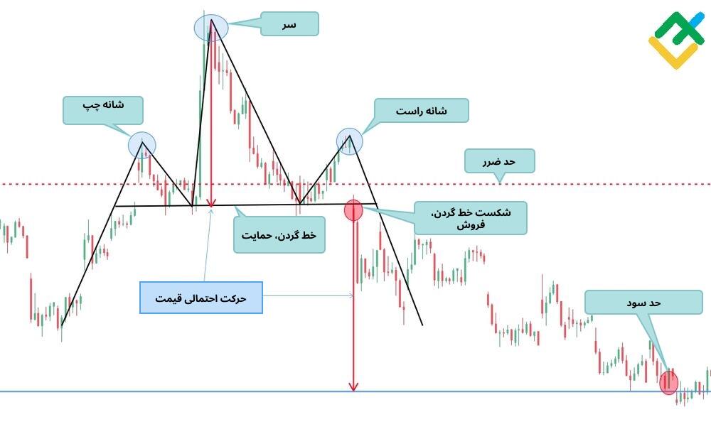 لایت فایننس: سر و شانه