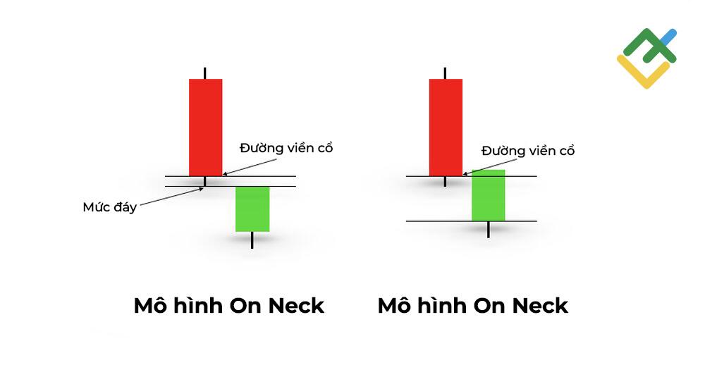 LiteFinance: Mô hình On Neck và In Neck