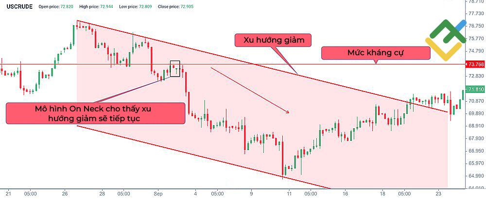 LiteFinance: Cách nhận diện mô hình On Neck